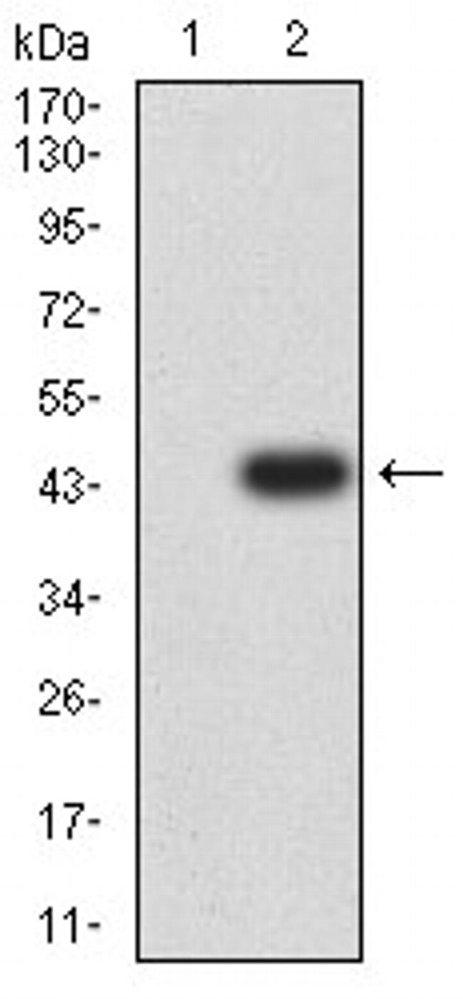 Textile Negative Ion Testing